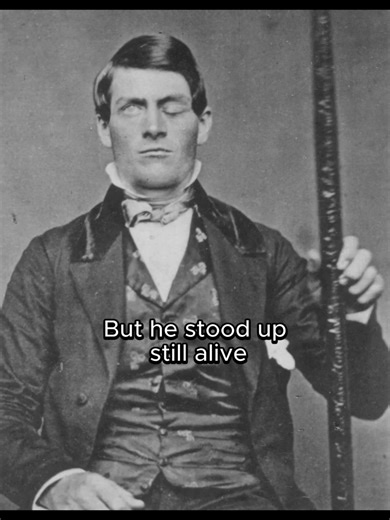 Phineas Gage: The Remarkable Survival Story of a Brain Injury