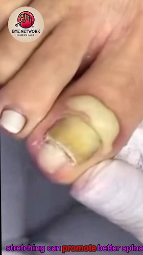 77K views · 284 reactions | Best guidance for senior toenails using mindful safe daily routines  #NailCareBasics #GentleSelfCare #DailyWellness | Bye | Facebook