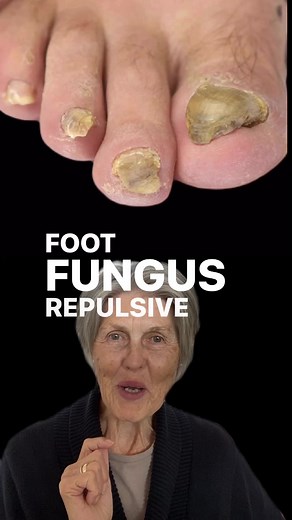 Effective Treatment with Manuka Oil for Foot and Toe Fungus