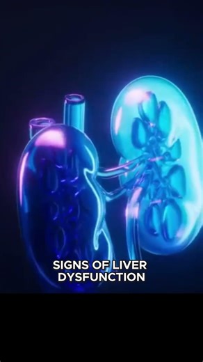 Dark Urine Warning Signs You Shouldn't Ignore