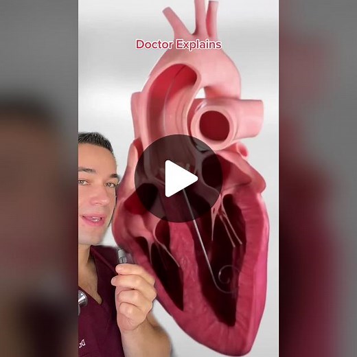 Understanding Aortic Stenosis: Causes and Treatment Explained