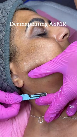 Dermaplaning ASMR leaves her with Glass Skin 🪞🔪🫧✨🔊 Blade is from @dermaplanepro use my code “MH10” for a discount 💰 #dermaplane #dermaplaning #dermaplaningfacial #facial #facialtreatments #facials #asmr #asmrvideo #asmrsounds #satisfying #hair #hairremoval #sounds #satisfyingvideo #longisland #newyork #hicksville #longislandny #esthetician | Michelle Hashimi