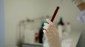 Chemical Laboratory Testing Drug Samples Stock Footage Video (100% Royalty-free) 3516577969 | Shutterstock