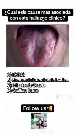 Comment below👇🏽 Want to revise this topic? #medicalnotes #haematology #medicalschool #medstudent #medicalstudent #osce #usmlestep1 #cardiology #endocrinology #nephrology #neurology #respiratory #orthopedics #rheumatology #neuroscience