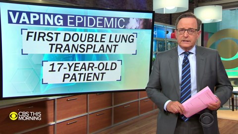 Teen receives double lung transplant for vaping-related injuries