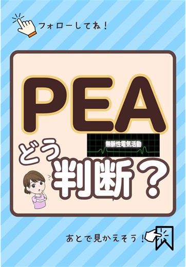 PEAの心電図と看護の基本を1分で学ぼう