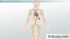 Non-Hodgkin's Lymphoma: Definition, Location, Signs & Treatments