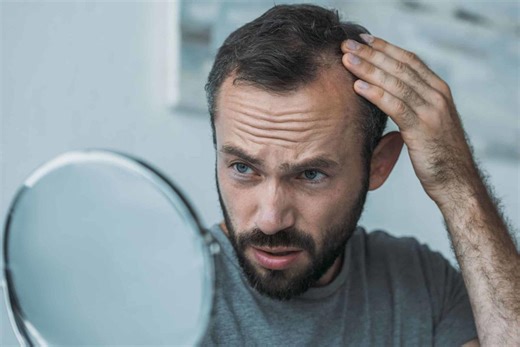 M-shaped hairline vs. Widow’s peak: Do you know the difference?