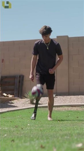 Playing Soccer with a Prosthetic Leg!