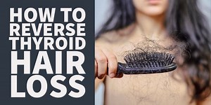 How to Reverse Thyroid Hair Loss and regrow your hair