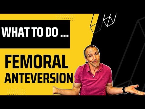 What Is Femoral Anteversion and How It Contributes to Hip, Knee, and Back Pain