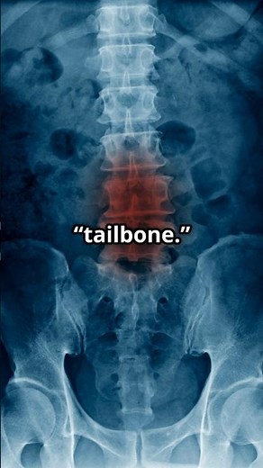 Yes, Humans Are Born With Tails — Here’s What Doctors Do About It