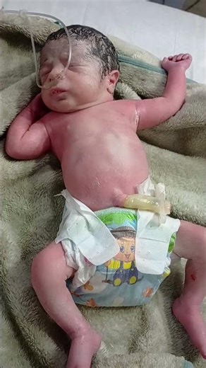 newborn baby critical baby emergency care o #nicucare #neonatologist #baby #oxygenmachine