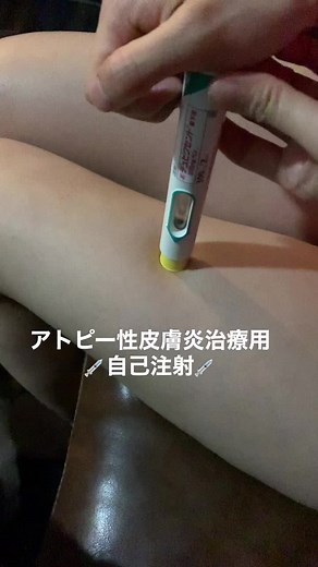 アトピー性皮膚炎治療の自己注射方法