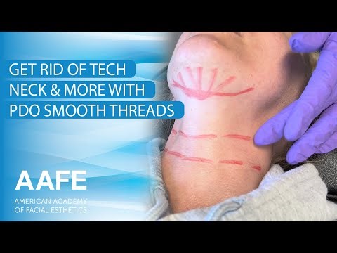 Get Rid of Tech Neck & More with PDO Smooth Threads