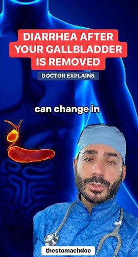 238K views · 2.2K reactions | DIARRHEA AFTER GALLBLADDER IS REMOVED — HEALTH TIPS GUT HEALTH | Dr. Joseph Salhab | Facebook