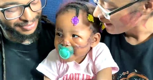 Toddler survives brutal dog bite to the face