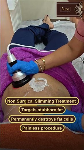 Cryogenic lipolysis Treatment aura 1