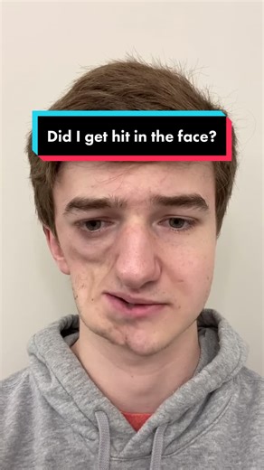 Understanding Parry Romberg Syndrome: A Rare Disease Response Video