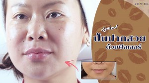 Review ปั้นปากสวยด้วยฟิลเลอร์จาก K.Aom ลูกค้า VIP...