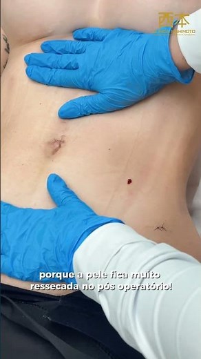 The importance of proper post-operative care with specialized professionals ✨
