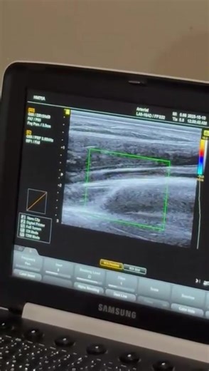 13K views · 127 reactions | One of our candidates localizes and does...