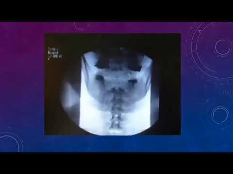 Clase de Faringograma y Esofagograma