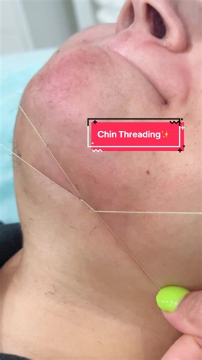 Chin Threading: Precision Techniques for Hormonal Hair Removal