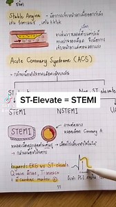 13K views · 378 reactions | UA vs NSTEMI vs STEMI สั้นๆใน 1 นาที ฉบับ นศ.พยาบาล . ฝากติดตาม tiktok ด้วยนะงับ st.nurse | ST.Nurse | Facebook