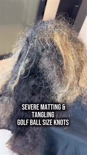 🚨Part 1: Tackling Severe Matting!🚨😲 Join me on this journey of transforming a client's matted hair from golf ball-sized knots to silky smooth lengths! 🎥👩‍🦰 Watch step-by-step as we carefully detangle & demat, ensuring a pain-free process.🙌 Whether matting came from illness, postpartum, or life's chaos, know you're not alone.💖 This is a safe, judgment-free zone where hair challenges have solutions!🤝 Need help? Click the link in my bio to book or DM to chat!🗨️ Let's handle it, one step a