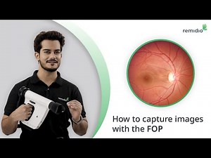 How to Capture Images with the FOP