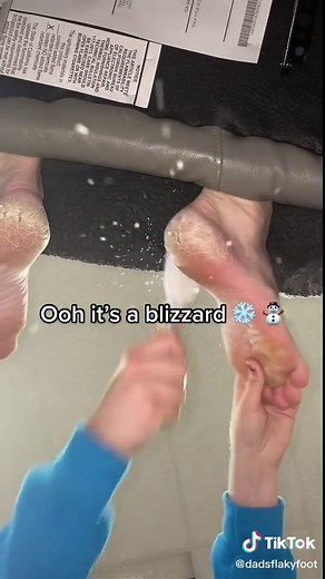 Fixing Crusty Feet: Tips and Tricks for Smooth Soles