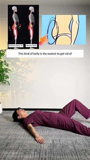 Fix Your Anterior Pelvic Tilt at Home in Just 5 Minutes a Day and Flatten Your Lower Belly Fast #fitness #workoutmotivation #workout #dailyworkout #plank