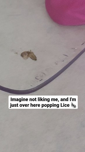 4.8K views · 444 reactions | How I spend my free time  #RGVLiceLady #licepopping #headlice #piojos | LRS - Lice Removal Service | Facebook