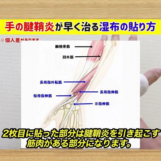 【腱鞘炎が早く治る】"正しい湿布の貼り方"で手の腱鞘炎を爆速改善 #shorts