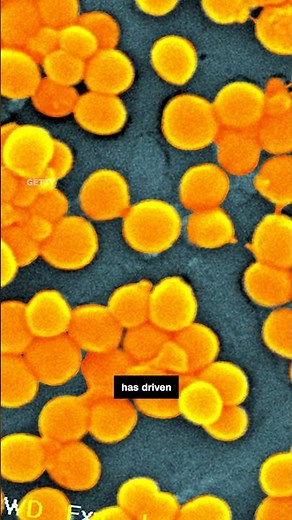 Superbug crisis could kill millions