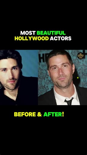 Famous Celebrities and Their Plastic Surgery Secrets