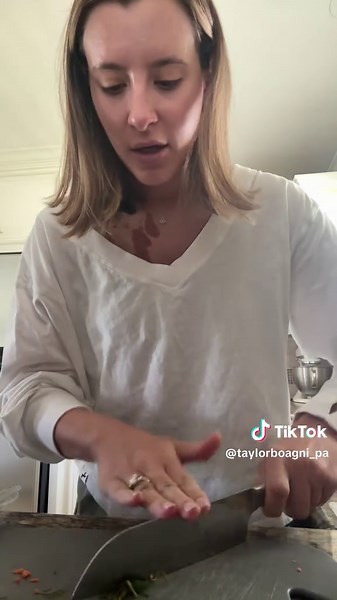 You’re reminder to be careful with knives 😅 What started out as making lunch ends up having to go get stitches! 🥲 thankful for knowing people in the industry to help in a hurry❤️‍🩹 #snitchesgetstitches