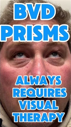 The importance of prescribing prisms and doing visual therapy if you have BVD #prisms #BVD