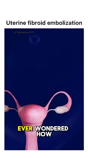 Animations | Follow @surgicalanimation for more! 🏥 | Instagram