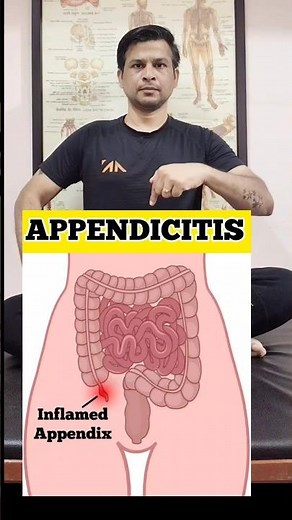 Best Exercises for Appendicitis Relief #shorts #tranding