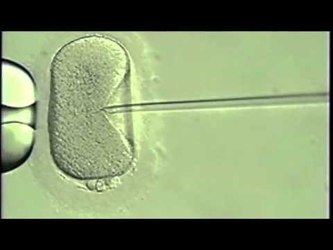 Overcoming Infertility - Intracytoplasmic Sperm Injection, Pioneered by UCSF