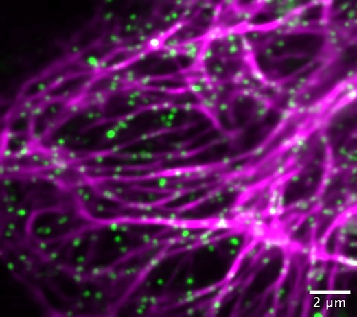 Uncovering the Complexities of Cellular Cytoskeletons - News Center