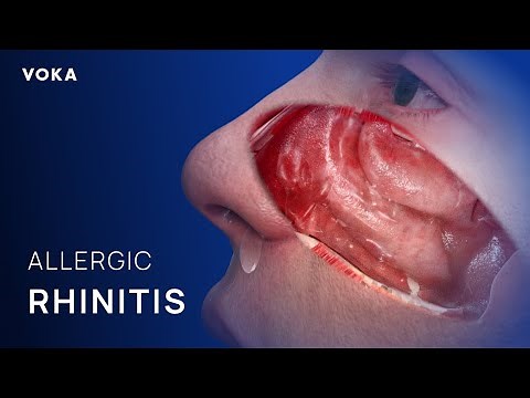 Breaking the Allergy Cycle: The Science of Histamine & Mast Cell Stabilization Explained in 3D