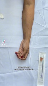 ¿Cómo tomar una gasometría arterial? #gasometria #arterias #angiologia #medicina #enfermeria | Enfermería a la mexicana