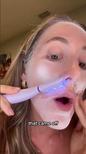 2 in 1 Facial Exfoliation & Peach Fuzz Hair Removal System