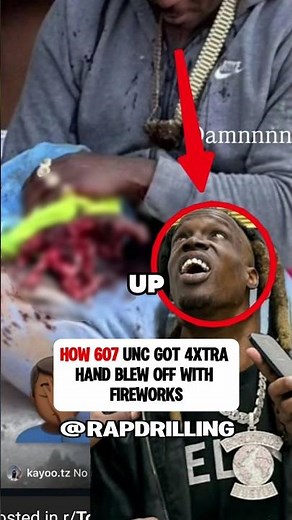How 607 UNC Got 4xtra's Hand Blew off with Fireworks 😮 #4xtra #607unc