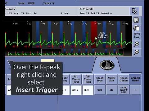 CT ECG Editing Scenario