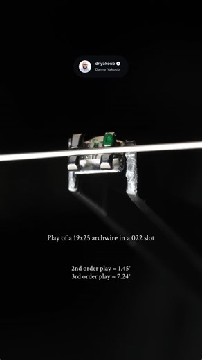 Danny Yakoub on Instagram: "Back to basics 🙇🏻 Understanding slot and wire dimensions is fundamental to precise orthodontic control. True control begins when we fully engage the wire within the bracket slot and understand how it expresses in all three orders: • First order – in–out control • Second order – tip control • Third order – torque control Each order is governed by specific couple force systems. When we understand how these couples are generated and expressed within the slot, we gain r