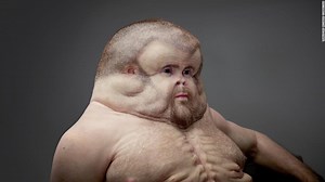 "Graham" is what you might look like if humans evolved to survive car crashes. http://cnn.it/2aab9Ys | CNN